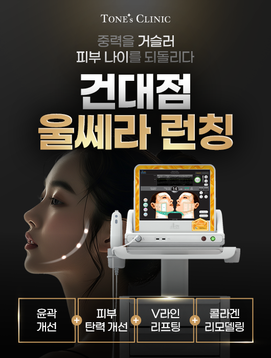 팝업
